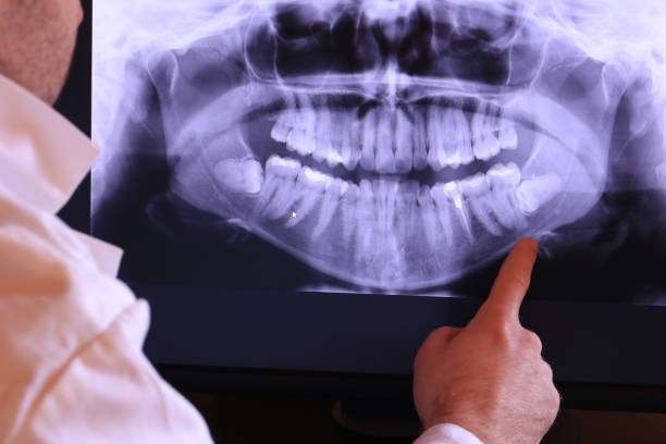 Best Emergency Broken Tooth Repair in Lake Success, NY